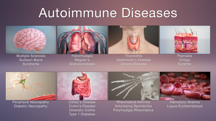 Autoimmune-Diseases