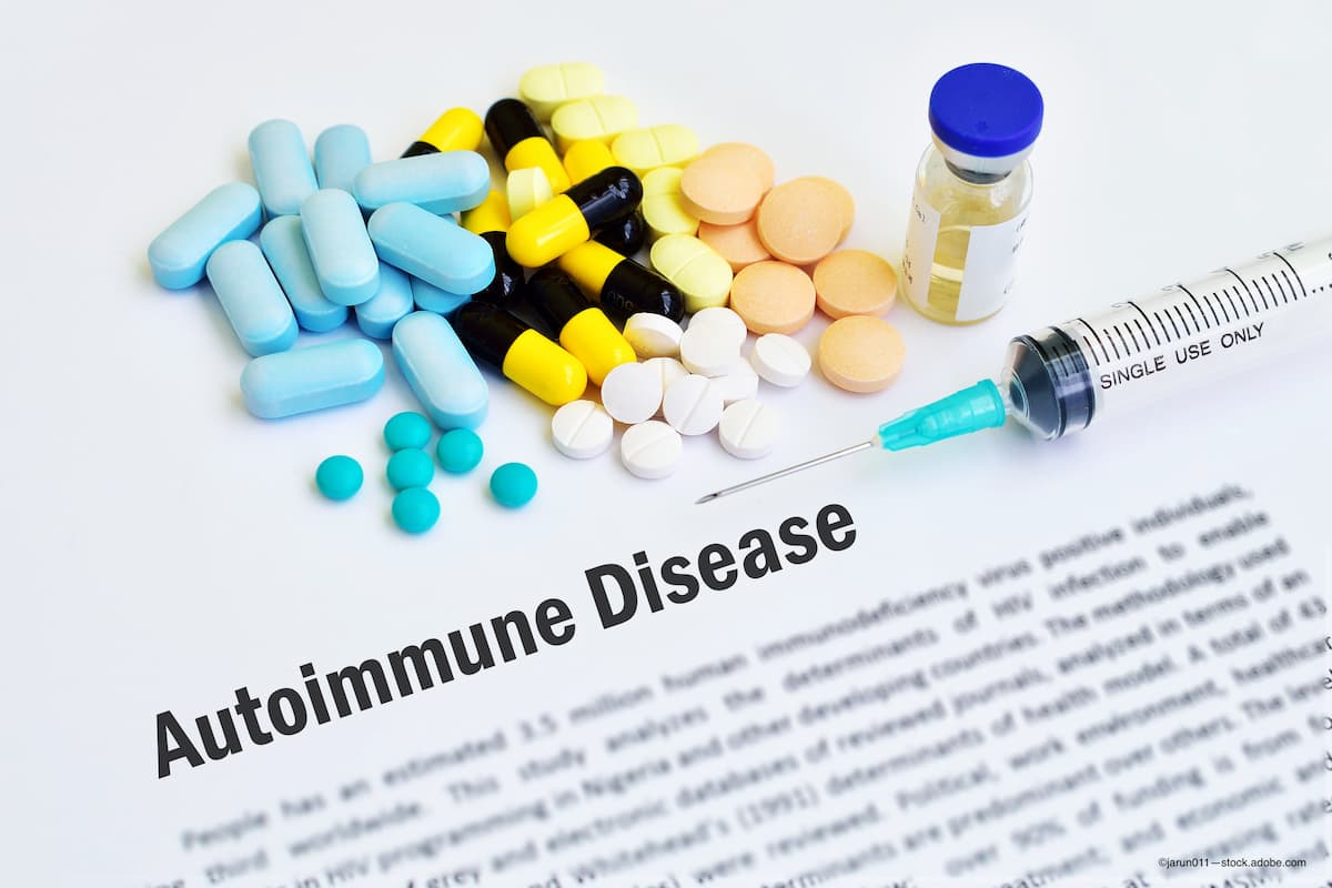 treatment for autoimmune diseases